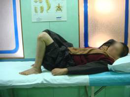 Intra Articular Fractures 